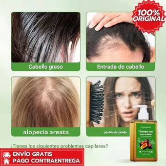 Batana Oil Shampoo™-Batana y Romero que Repara, Hidrata y Suaviza el Cabello